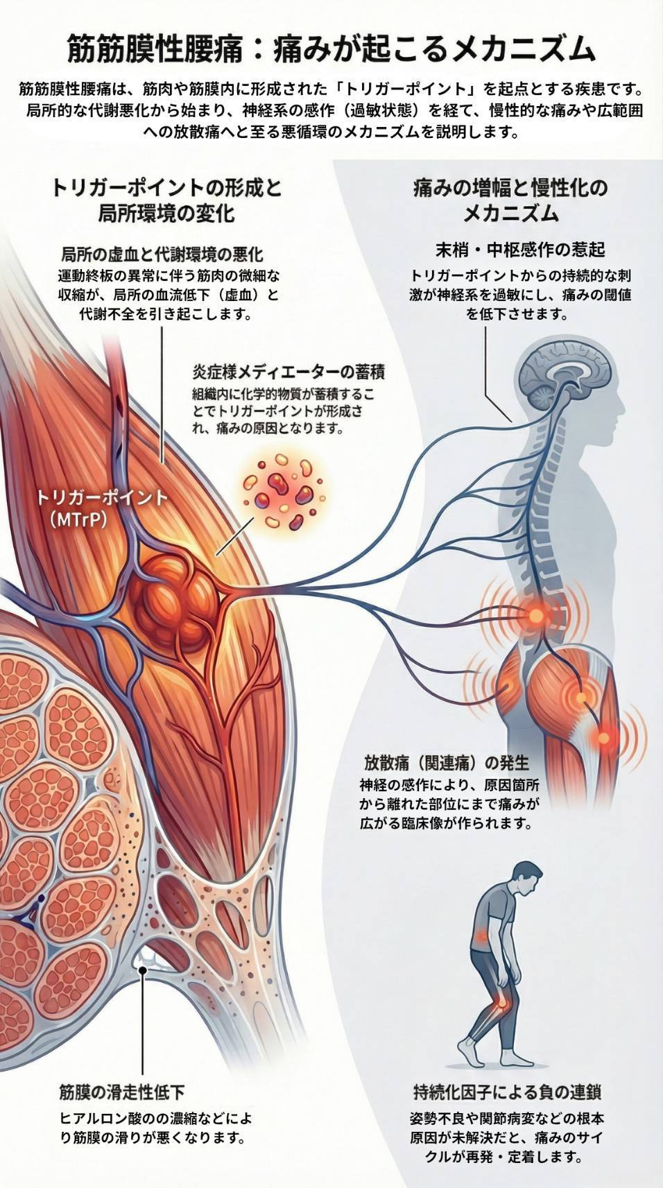 筋筋膜性腰痛の痛みが起こるメカニズム