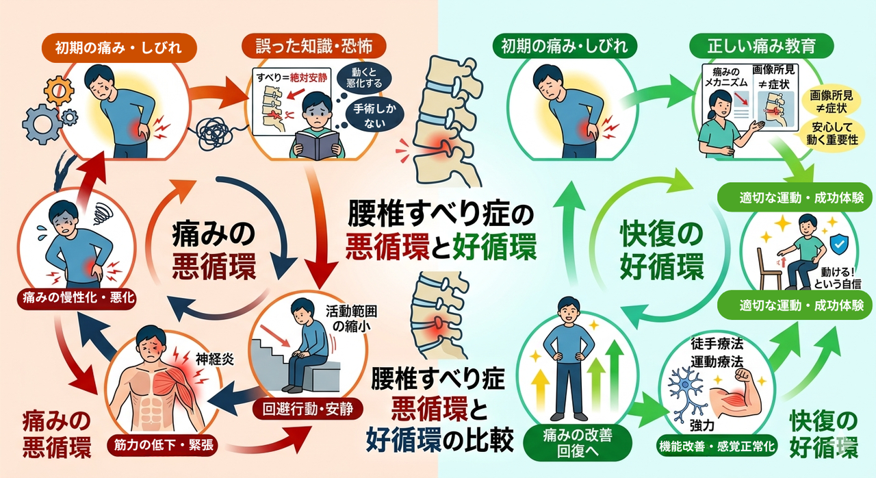 腰椎すべり症の治らない悪循環と治っていく好循環の図