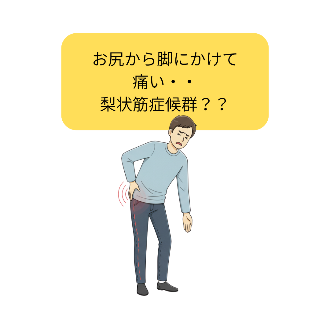 梨状筋症候群の患者さん