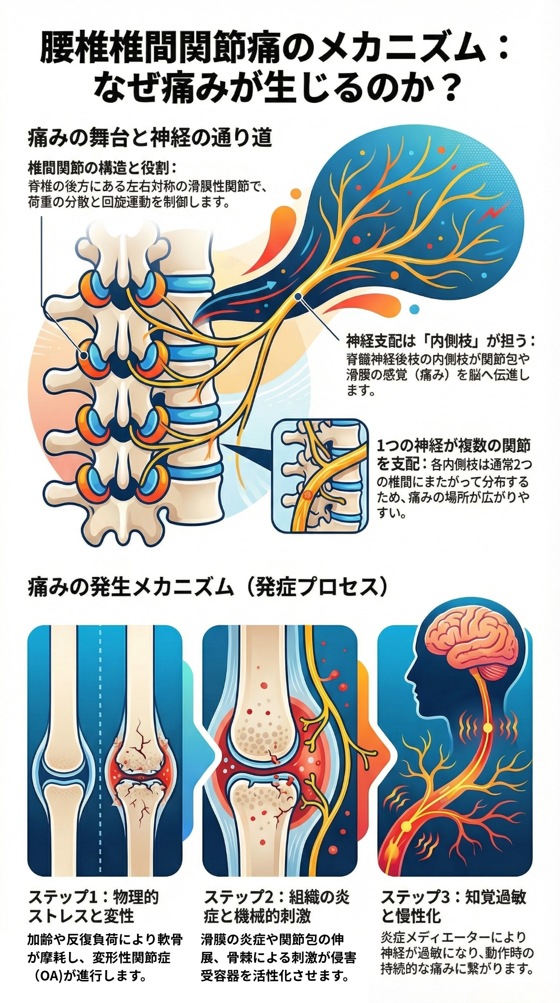 腰椎椎間関節痛のメカニズム