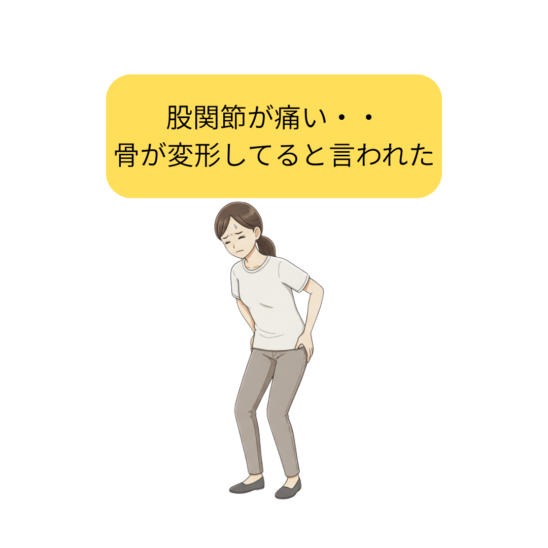 変形性股関節症の患者さん