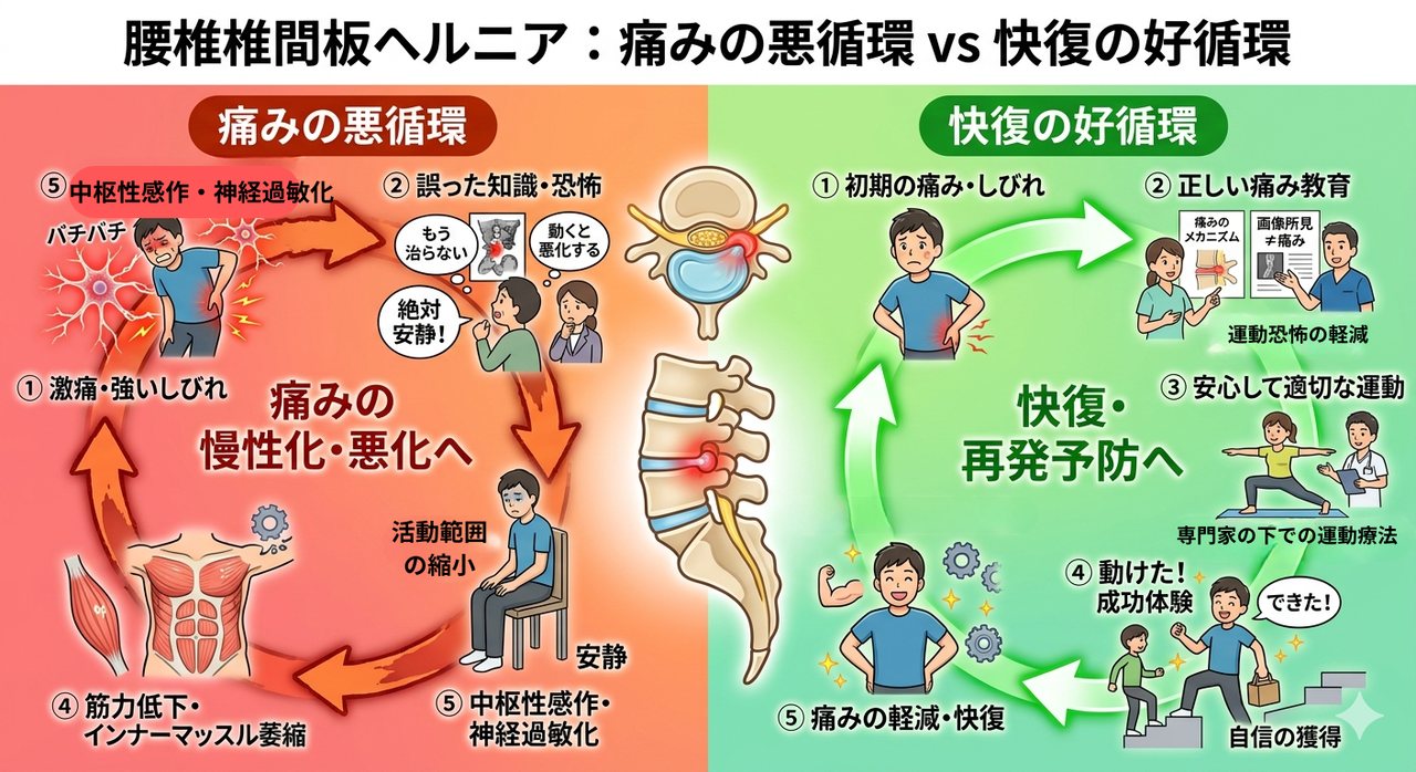 腰椎椎間板ヘルニア：痛みの悪循環VS回復の好循環