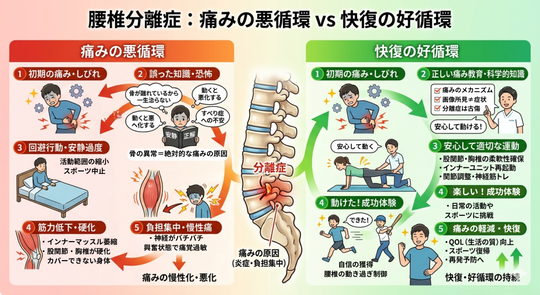 腰椎分離症の治らない悪循環と治っていく好循環の図