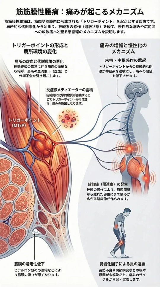 筋筋膜性腰痛の痛みが起こるメカニズム