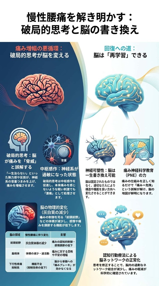 劇的！脳から腰痛アプローチ 破局的思考と慢性腰痛のメカニズム：神経生物学的理解と実践ガイド